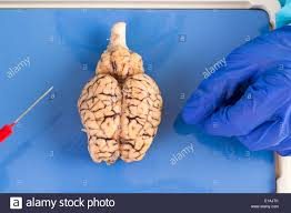 Vaca entera cerebro vistos desde arriba mostrando los dos ...