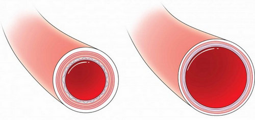 DICCIONARIO DE BIOLOGIA: ¿QUÉ ES VASODILATACION?