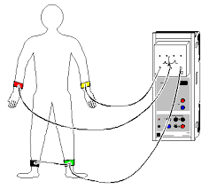 Electrocardiograma (ECG)